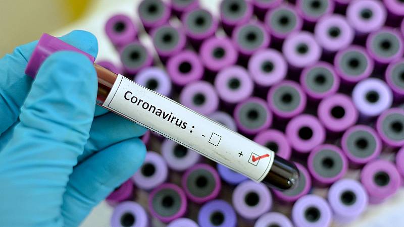 Coronavirus Foto: Internet