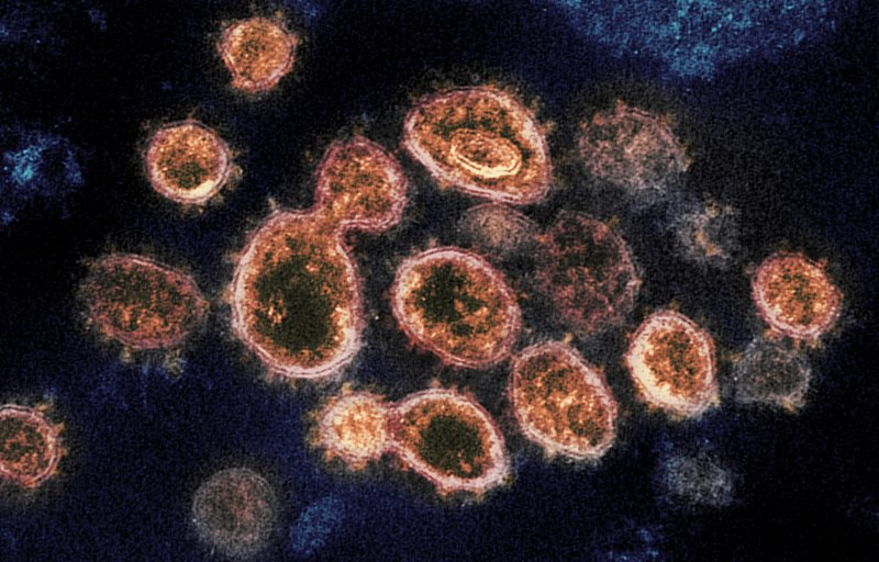 Nueva variante de coronavirus llega a EEUU Foto: AP