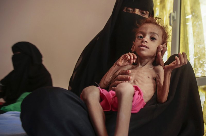 Yemen Foto: AP