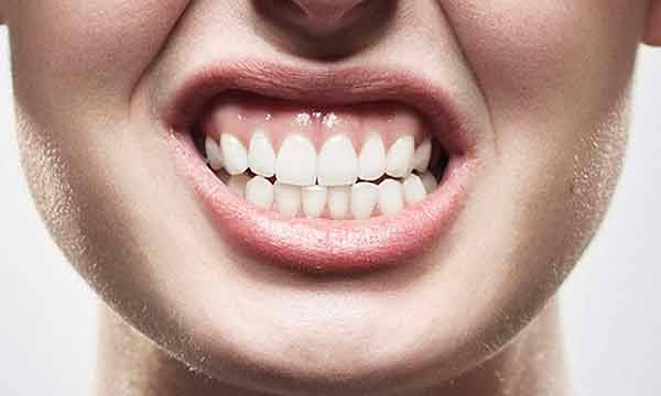 80% de los mexicanos rechinan los dientes, informa académica de la UNAM Foto: UNAM