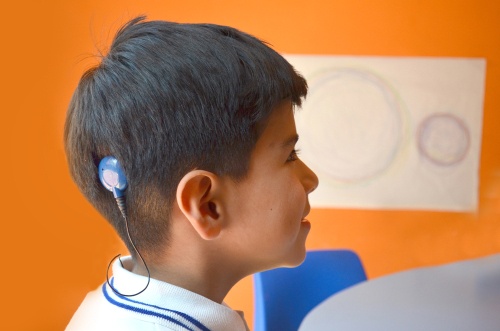 Implante Coclear evita incapacidad auditiva, destaca ISSSTE Foto: Internet