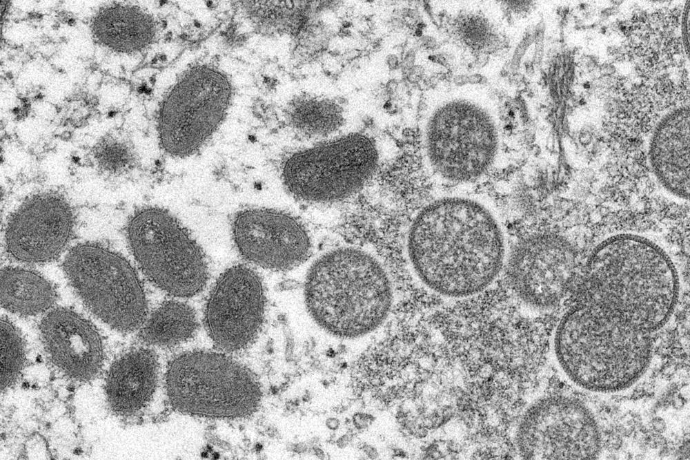 ¿Qué es la viruela símica y dónde se propaga?