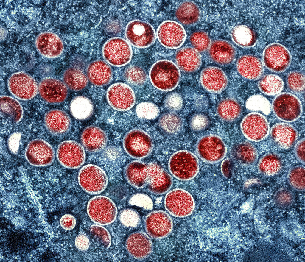 OMS cambia el nombre de la viruela símica a mpox