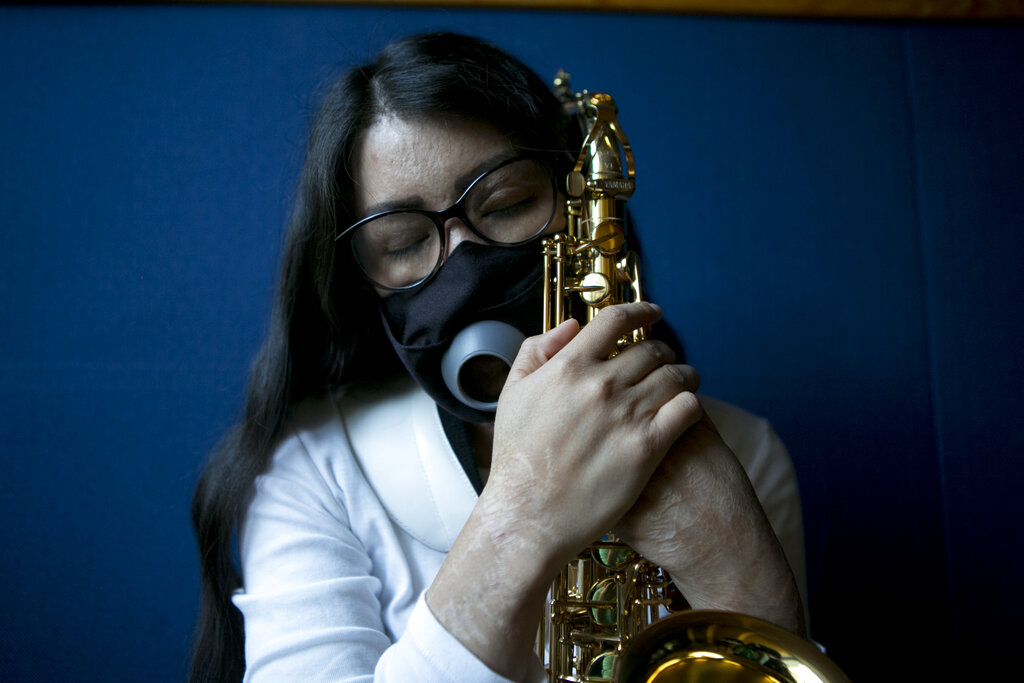El saxofón, aliento de artista mexicana atacada con ácido